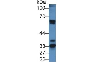 Detection of FGA in Mouse Kidney lysate using Polyclonal Antibody to Fibrinogen Alpha Chain (FGA) (FGA antibody  (AA 34-255))