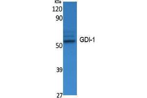 Western Blotting (WB) image for anti-GDP Dissociation Inhibitor 1 (GDI1) (C-Term) antibody (ABIN3178068) (GDI1 antibody  (C-Term))