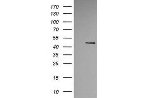 Image no. 1 for anti-tRNA 5-Methylaminomethyl-2-Thiouridylate Methyltransferase (TRMU) antibody (ABIN1501523) (TRMU antibody)