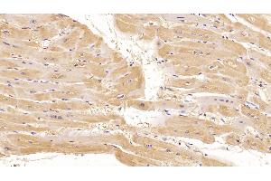 Detection of CTGF in Human Cardiac Muscle Tissue using Monoclonal Antibody to Connective Tissue Growth Factor (CTGF) (CTGF antibody  (AA 248-349))