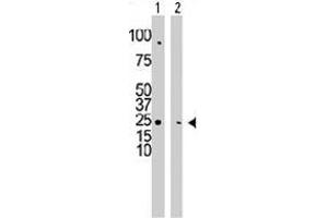 The CMPK1 polyclonal antibody  is used in Western blot to detect CMPK1 in HepG2 cell lysate (Lane 1) and mouse cerebellum tissue lysate (Lane 2) . (Cytidine Monophosphate (UMP-CMP) Kinase 1, Cytosolic (CMPK1) (C-Term) antibody)