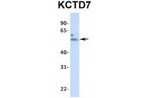 Host:  Rabbit  Target Name:  KCTD7  Sample Type:  Human Fetal Heart  Antibody Dilution:  1. (KCTD7 antibody  (N-Term))