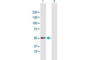 Western Blotting (WB) image for anti-Protein Kinase C and Casein Kinase Substrate in Neurons 1 (PACSIN1) (AA 1-444) antibody (ABIN526214)