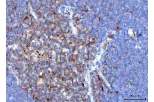 IHC analysis of TCR alpha/TRAC using anti-TCR alpha/TRAC antibody (ABIN6719654). (TRAC antibody  (AA 1-114))