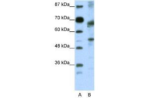 WB Suggested Anti-TCF12  Antibody Titration: 0. (TCF12 antibody  (N-Term))