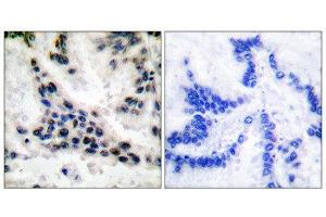 Immunohistochemistry (IHC) image for anti-Histone Deacetylase 1 (HDAC1) (C-Term) antibody (ABIN1848594) (HDAC1 antibody  (C-Term))