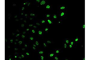 Immunofluorescence analysis of HeLa cells using E2F6 antibody. (E2F6 antibody)