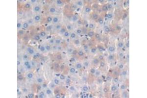 IHC-P analysis of Rat Tissue, with DAB staining. (CD8 alpha antibody  (AA 26-236))