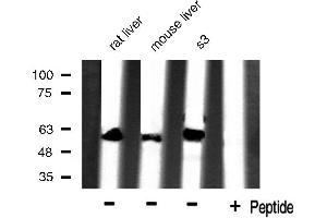 Western blot analysis of extracts of various celllines,using HSP60 antibody. (HSPD1 antibody)