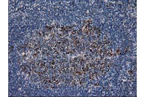 Image no. 4 for anti-Dihydrolipoamide Dehydrogenase (DLD) antibody (ABIN1497846) (DLD antibody)