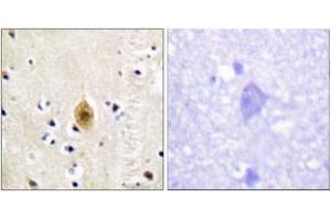 Immunohistochemistry analysis of paraffin-embedded human brain, using Mst1/2 (Phospho-Thr183) Antibody. (MST1/MST2 (AA 149-198), (pThr183) antibody)
