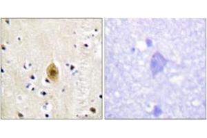Immunohistochemistry analysis of paraffin-embedded human brain, using Mst1/2 (Phospho-Thr183) Antibody. (MST1/MST2 (AA 149-198), (pThr183) antibody)