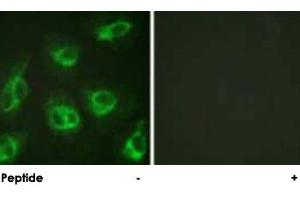 Immunofluorescence analysis of HeLa cells, using KCNIP3 polyclonal antibody .