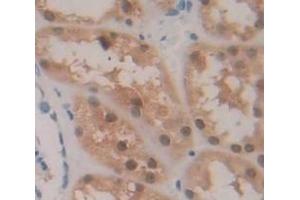 #VALUE! (HIPK2 antibody  (AA 977-1198))