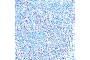 Immunohistochemistry of paraffin-embedded mouse spleen using SNRPB Rabbit pAb (ABIN6134519, ABIN6148214, ABIN6148215 and ABIN6219175) at dilution of 1:100 (40x lens). (SNRPB antibody  (AA 1-100))
