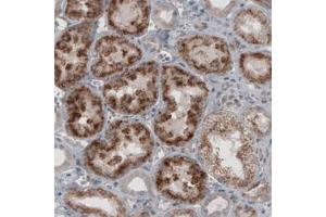 Immunohistochemical staining (Formalin-fixed paraffin-embedded sections) of human kidney with ACAA1 monoclonal antibody, clone CL2663  shows granular cytoplasmic immunoreactivity in renal tubules. (ACAA1 antibody)