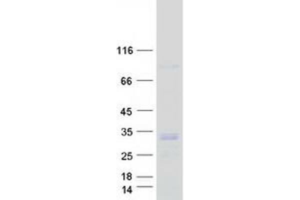 Deoxyguanosine Kinase Protein (DGUOK) (Transcript Variant 1) (Myc-DYKDDDDK Tag)