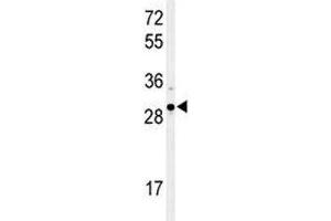 Western blot analysis of XBP1 antibody and Ramos lysate. (XBP1 antibody  (AA 62-91))