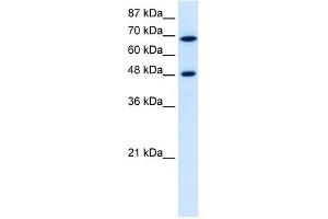 WB Suggested Anti-RRP9 Antibody Titration:  5. (RRP9 antibody  (Middle Region))