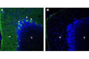 Expression of CD38 in rat cerebellum. (CD38 antibody  (Extracellular))