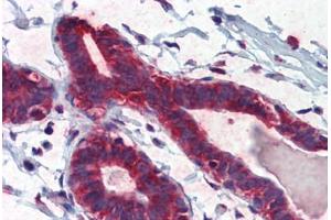 Human Breast (formalin-fixed, paraffin-embedded) stained with TBX5 antibody ABIN462189 followed by biotinylated goat anti-rabbit IgG secondary antibody ABIN481713, alkaline phosphatase-streptavidin and chromogen. (T-Box 5 antibody  (AA 174-223))