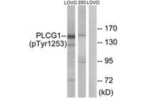 Western blot analysis of extracts from LOVO cells treated with and 293 cells treated with heat shock, using PLCG1 (Phospho-Tyr1253) Antibody.