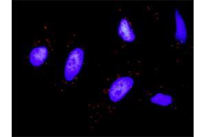 Proximity Ligation Analysis of protein-protein interactions between STAT1 and KIT. (KIT antibody  (AA 41-140))