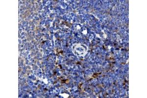 IHC analysis of NOXA2/p67phox/NCF2 using anti-NOXA2/p67phox/NCF2 antibody (ABIN7599462).