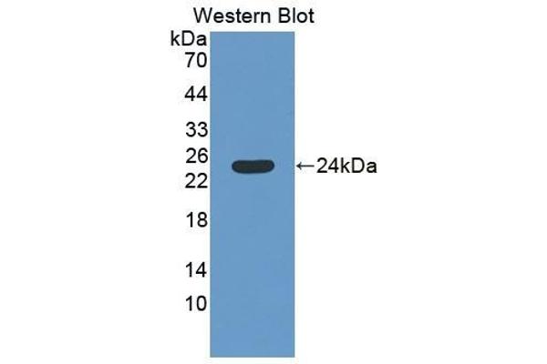 SAT1 抗体  (AA 1-171)