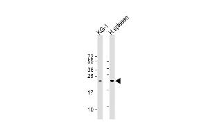 All lanes : Anti- LIF Antibody (Center) at 1:1000 dilution Lane 1: KG-1 whole cell lysate Lane 2:Human spleen whole cell lysate Lysates/proteins at 20 μg per lane. (LIF antibody  (AA 72-101))