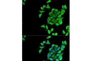 Immunofluorescence analysis of U2OS cells using KCNN3 Polyclonal Antibody (KCNN3 antibody)