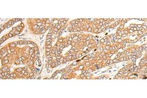 Immunohistochemistry (Paraffin-embedded Sections) (IHC (p)) image for anti-Cytochrome P450, Family 3, Subfamily A, Polypeptide 4 (CYP3A4) antibody (ABIN7003988)