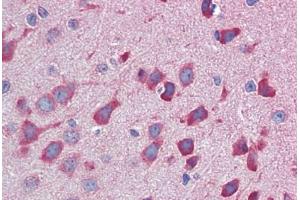 Mouse brain: Formalin-Fixed, Paraffin-Embedded (FFPE) (IL23A antibody  (C-Term))
