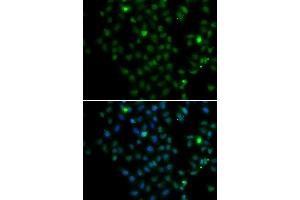 Immunofluorescence analysis of MCF7 cell using LMO4 antibody. (LMO4 antibody)