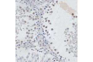Immunohistochemistry of paraffin-embedded rat testis using USP7/HAUSP antibody (ABIN6132280, ABIN6150032, ABIN6150034 and ABIN6217614) at dilution of 1:100 (40x lens). (USP7 antibody  (AA 206-1102))