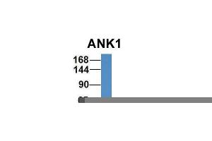 Host:  Rabbit  Target Name:  ANK1  Sample Type:  Human Fetal Liver  Antibody Dilution:  1. (Erythrocyte Ankyrin antibody  (Middle Region))