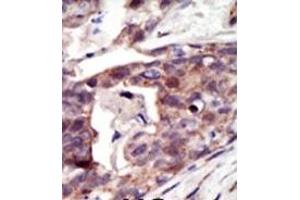 Image no. 2 for anti-Palmitoyl-Protein Thioesterase 1 (PPT1) (N-Term) antibody (ABIN357783) (PPT1 antibody  (N-Term))