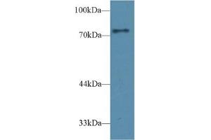 Detection of CD2AP in Rat Cerebrum lysate using Polyclonal Antibody to CD2 Associated Protein (CD2AP) (CD2AP antibody  (AA 368-623))