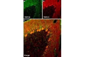 Immunohistochemistry (IHC) image for anti-Transient Receptor Potential Cation Channel, Subfamily C, Member 6 (TRPC6) (AA 24-38), (Intracellular) antibody (ABIN7043826)