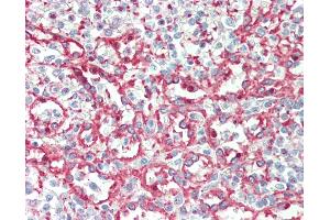 Anti-ITGA2B / CD41 antibody IHC staining of human spleen. (Integrin Alpha2b antibody  (AA 122-171))