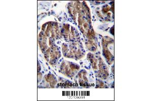 RPS4Y1 Antibody immunohistochemistry analysis in formalin fixed and paraffin embedded human stomach tissue followed by peroxidase conjugation of the secondary antibody and DAB staining. (RPS4Y1 antibody  (AA 76-105))