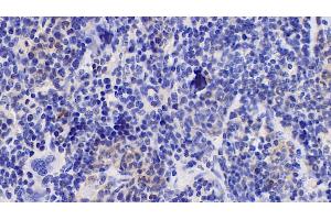 Detection of IL10 in Mouse Spleen Tissue using Monoclonal Antibody to Interleukin 10 (IL10) (IL-10 antibody  (AA 19-178))
