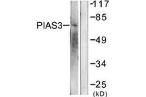 Western blot analysis of extracts from 293 cells, treated with UV 5', using PIAS3 Antibody. (PIAS3 antibody  (AA 10-59))