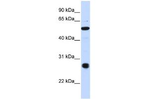 WB Suggested Anti-C6orf113 Antibody Titration:  0. (ZUFSP antibody  (C-Term))