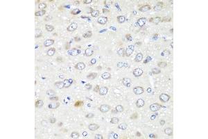 Immunohistochemistry of paraffin-embedded rat brain using G antibody (ABIN6129967, ABIN6140880, ABIN6140881 and ABIN6223736) at dilution of 1:200 (40x lens). (GABARAPL2 antibody  (AA 1-117))