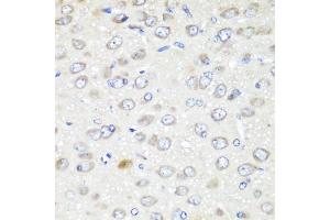 Immunohistochemistry of paraffin-embedded rat brain using G antibody (ABIN6129967, ABIN6140880, ABIN6140881 and ABIN6223736) at dilution of 1:200 (40x lens).