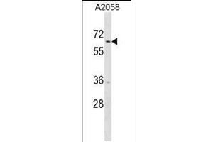 Western blot analysis in A2058 cell line lysates (35ug/lane). (TRIM35 antibody  (C-Term))