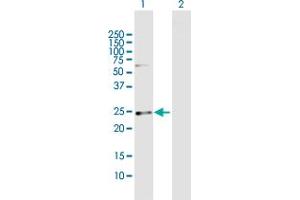 Western Blot analysis of CSN1S1 expression in transfected 293T cell line by CSN1S1 MaxPab polyclonal antibody. (Casein alpha S1 antibody  (AA 1-185))