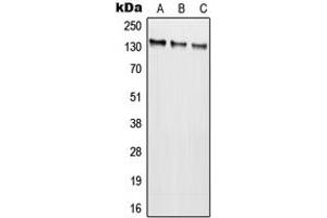 Western blot analysis of NMDAR2C expression in SKOVCAR (A), HEK293T (B), SP2/0 (C) whole cell lysates.