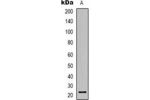 Western blot analysis of TCEAL6 expression in COLO205 (A) whole cell lysates. (TCEAL6 antibody)